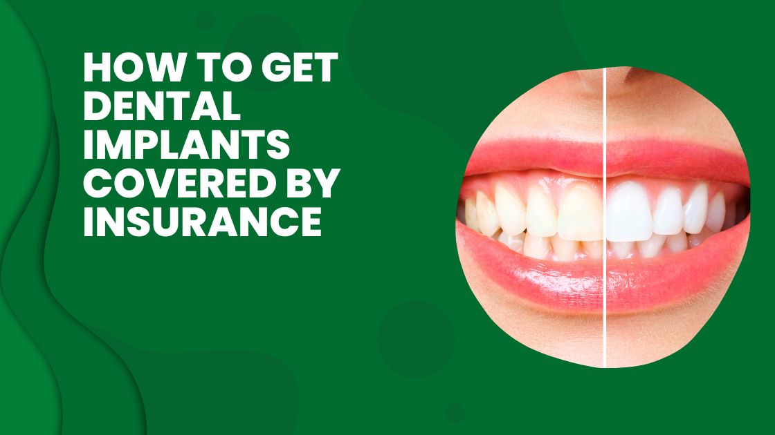 How to Get Dental Implants Covered by Insurance